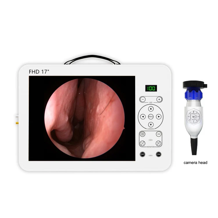 Sistema de Diagnóstico ORL con - Medical Lab Images reseña y precio